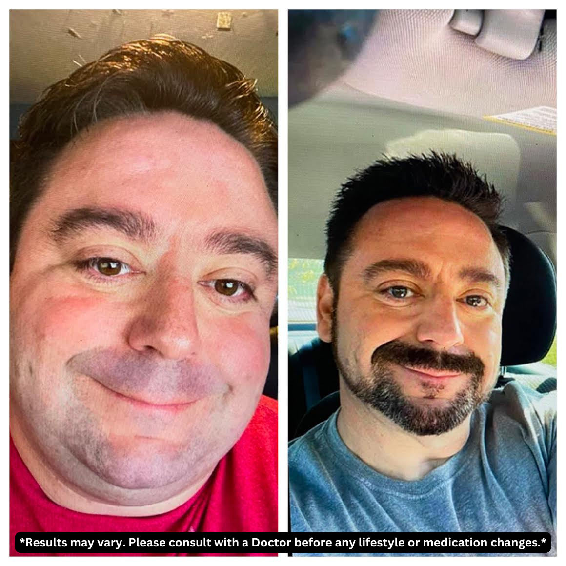 weigh_to_go_weight_loss_centers_review_Before_and_after_weight_loss