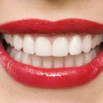 Image result for Whiten Your Teeth