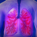Managing Tuberculosis With Isoniazid Antibiotic