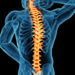 Lumbar Spinal Stenosis: Causes, Symptoms, and Treatment