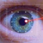 Why LASIK? The Advantages Of Getting It Done