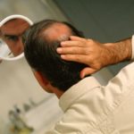 Poor Diet and Hair Loss: The Connection