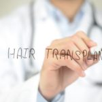 For FTM Patients, Body Hair Transplants Can Provide a More Masculine Look