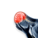 When should you use a lawyer for a TBI?