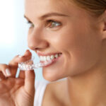 Solutions for Straightening Your Teeth